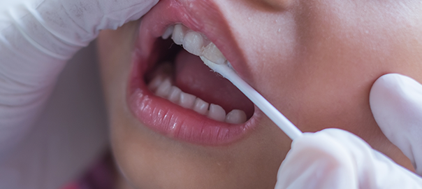 Pediatric Dentist Galang Dental Center treating child