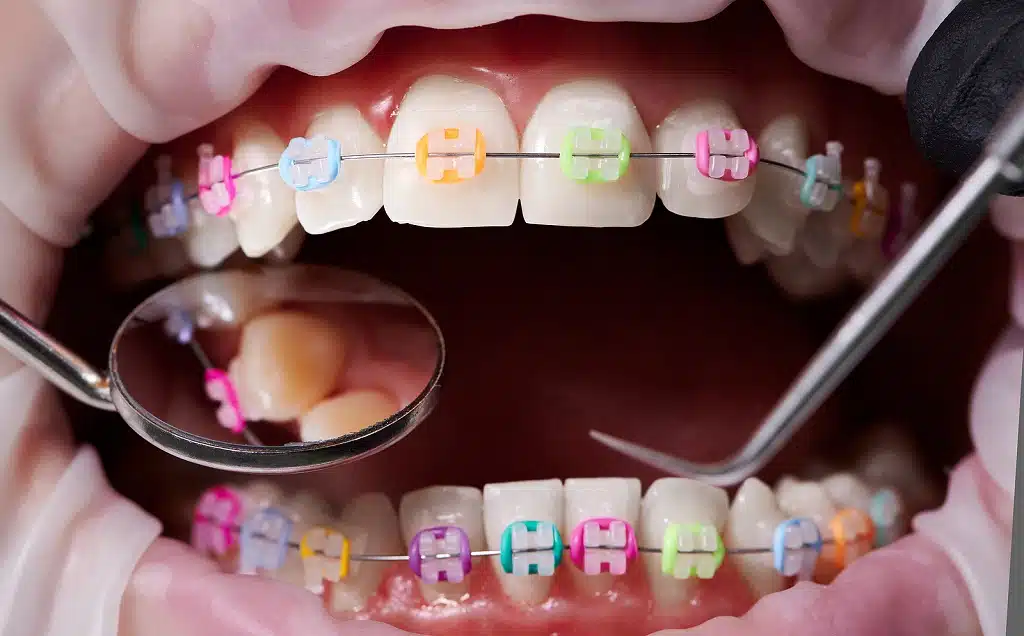Orthodontics 2 orthodontics