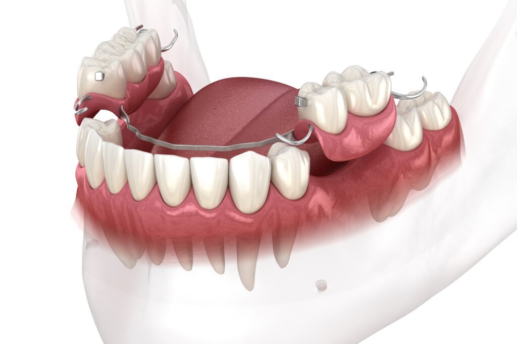 Dental Implants & Prosthodontics Galang Dental Center