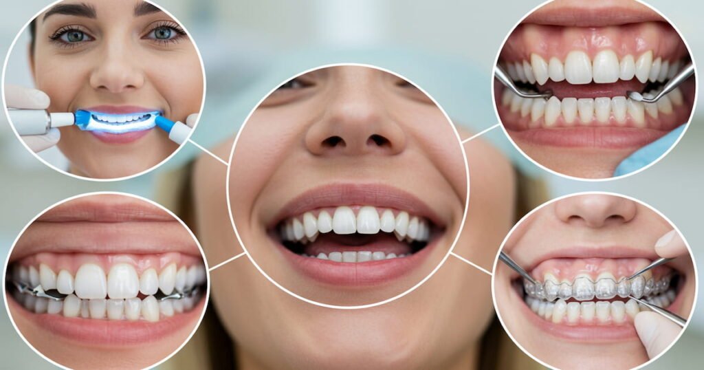 Blogs 14 dental treatment cost philippines teeth cleaning